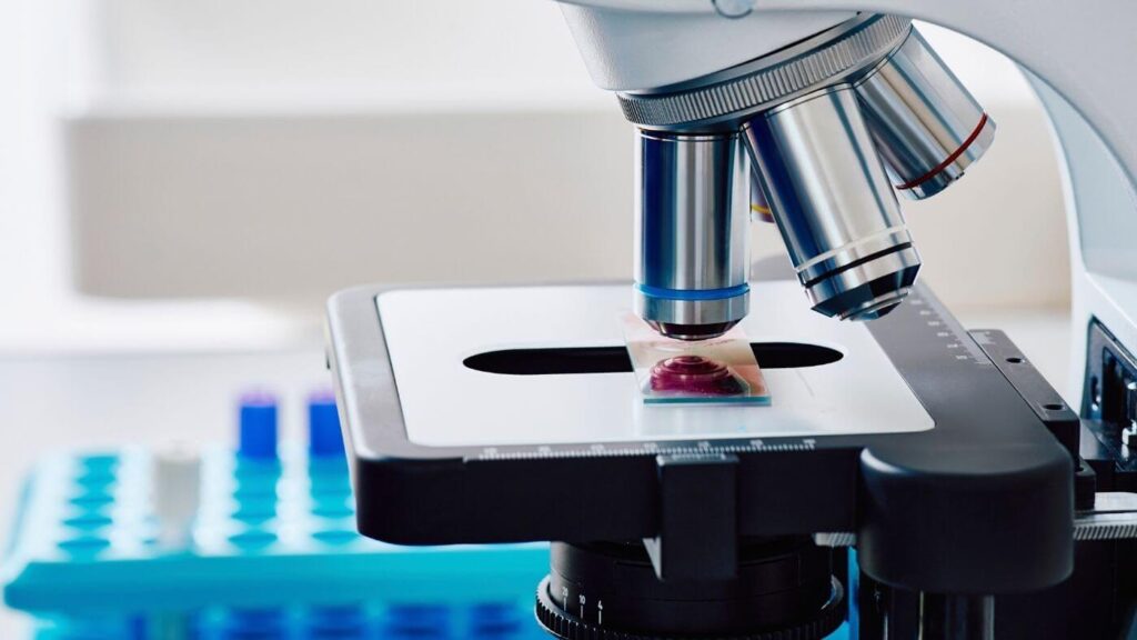 Exames Laboratoriais